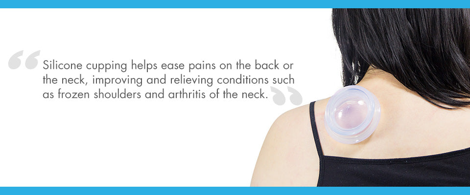 Silicone cupping treatment