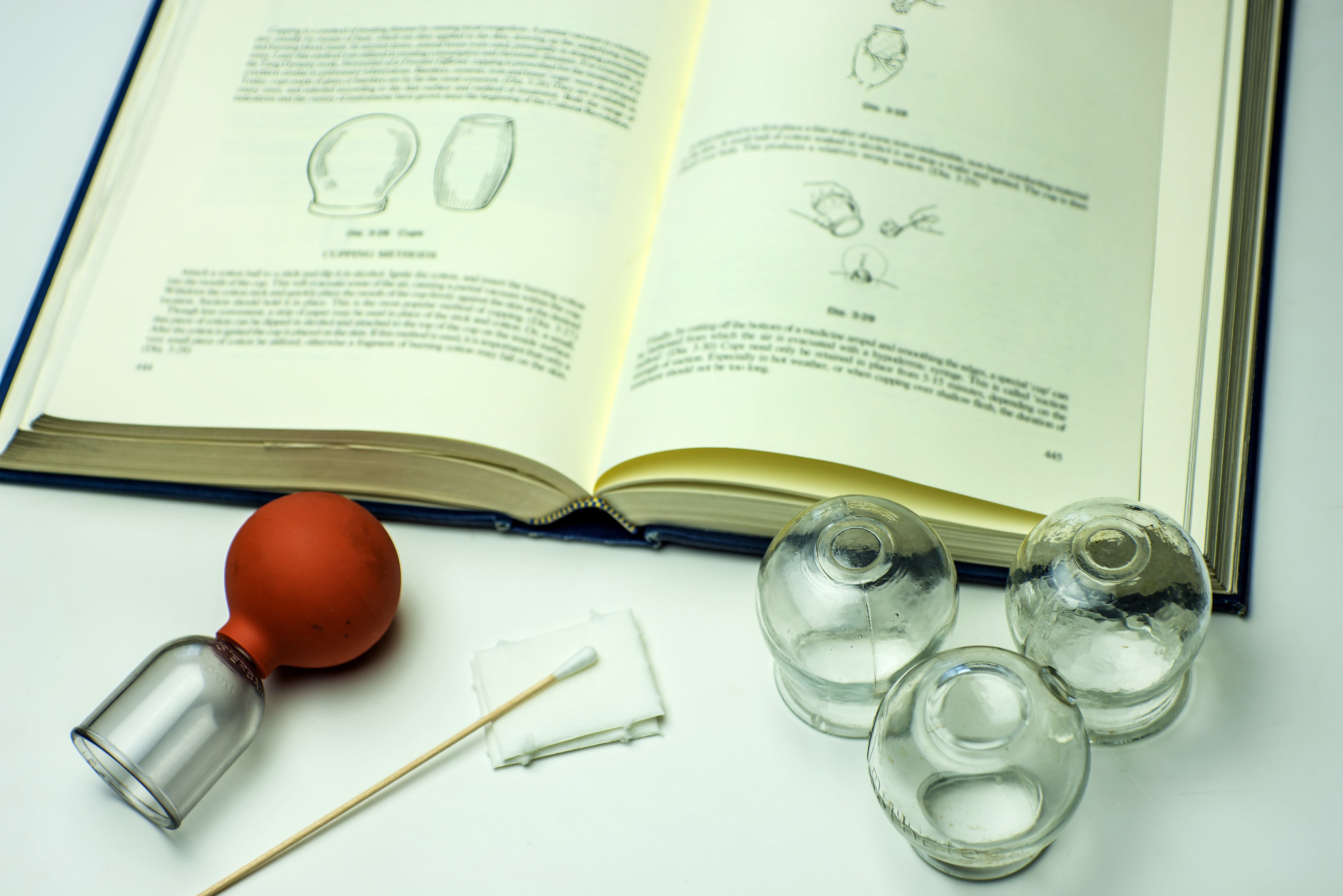 shop cupping treatment at lierre canada