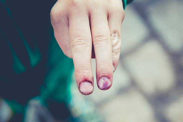 Side effects of acupuncture needles lierre