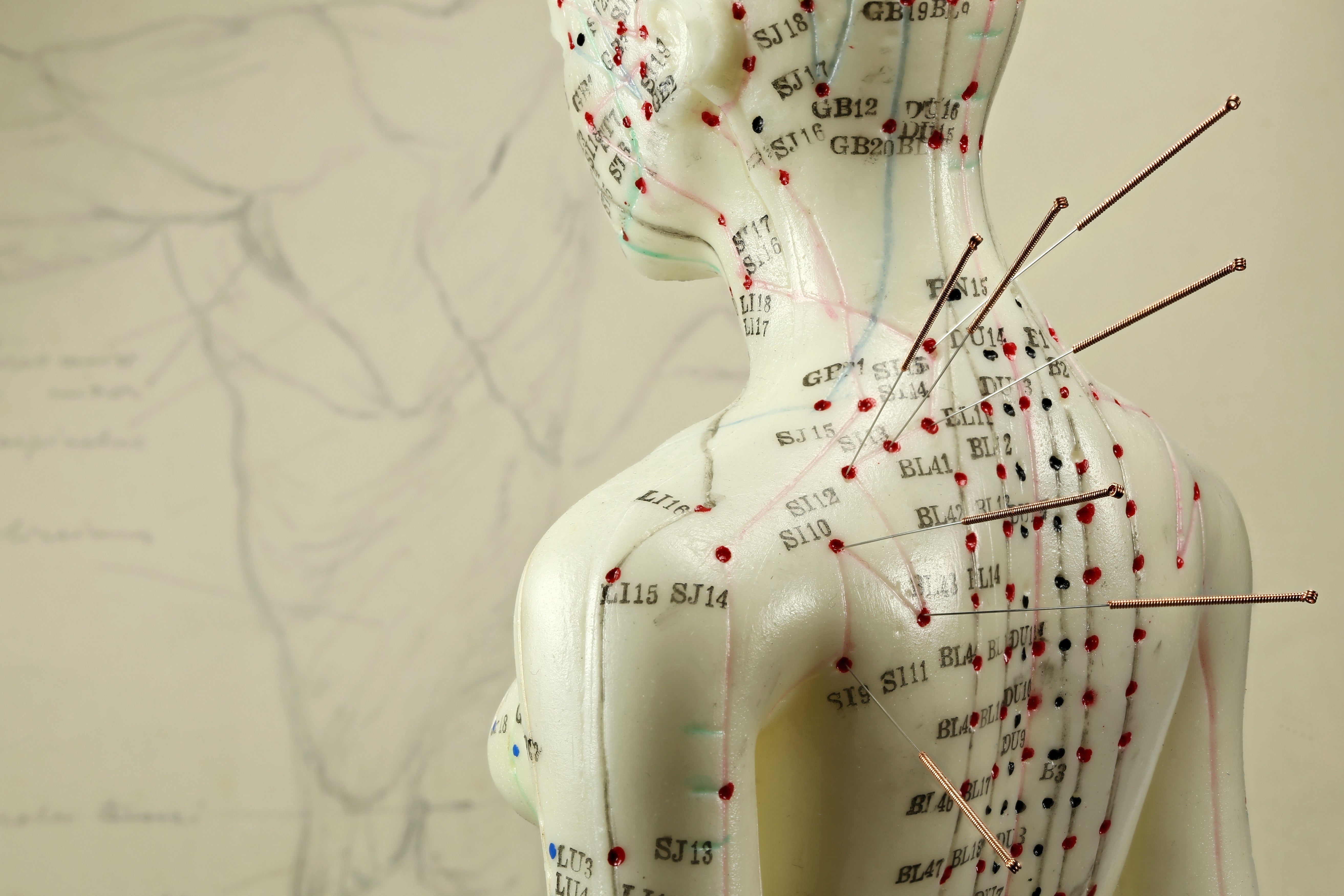 Shop acupuncture needle at lierre canada