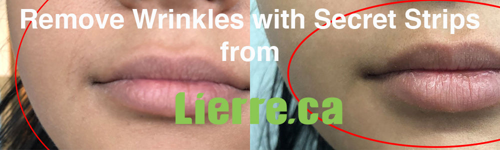 Before and After using acu lifting anti-aging Secret Strips from Lierre.ca Canada