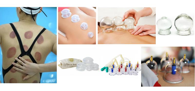 Cupping is now populating in Rio 2016, Olympians are crazy for this TCM therapy