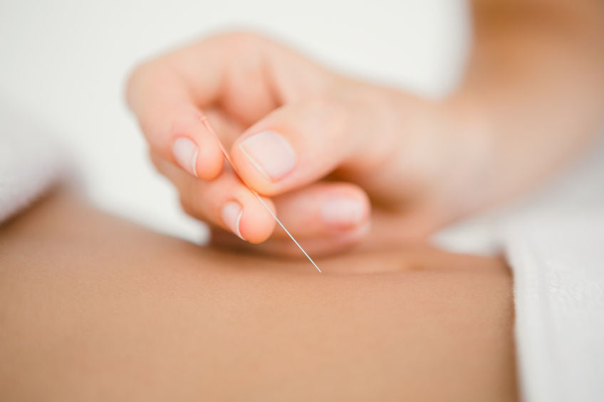 acheter aiguilles d'acupuncture chez lierre canada