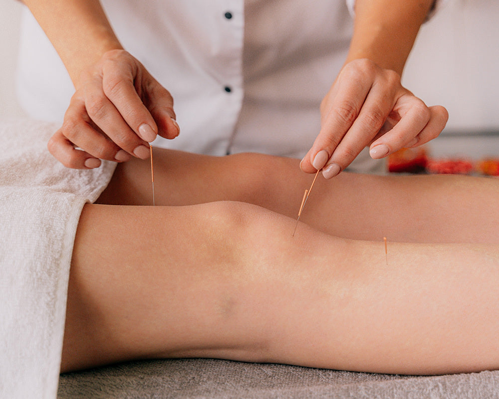 What should we know about acupuncture needles: sharpness, resilience and size