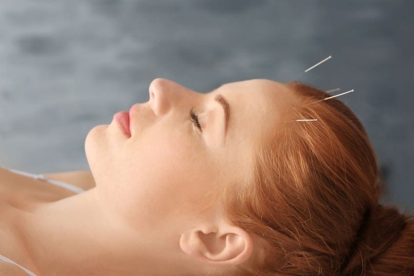 acheter des aiguilles d'acupuncture au canada chez lierre.ca