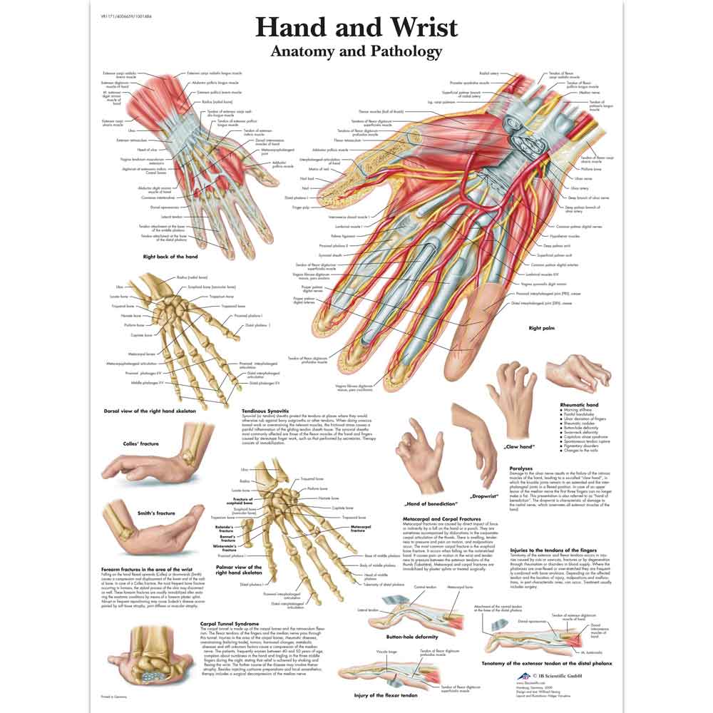 3B Scientific Hand and wrist anatomy and pathology