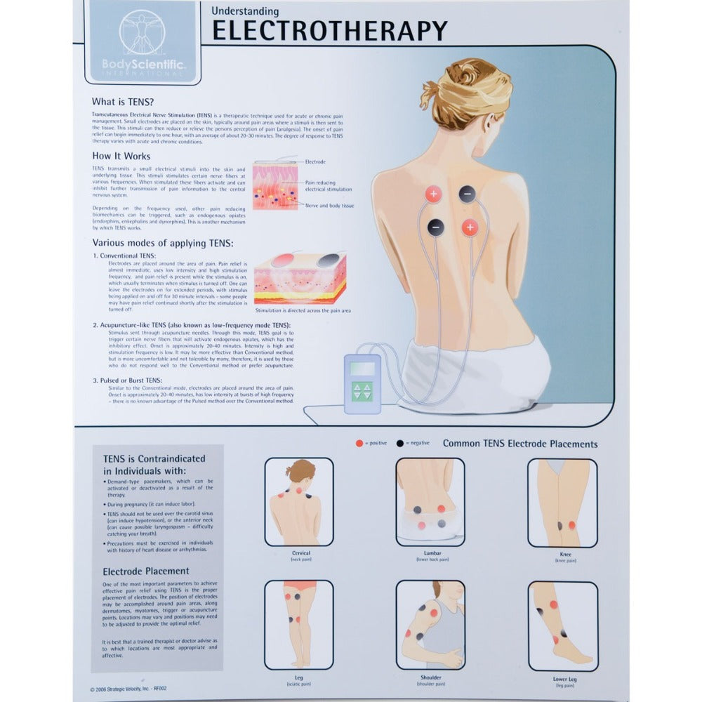 Electrotherapy Chart – English, Laminated