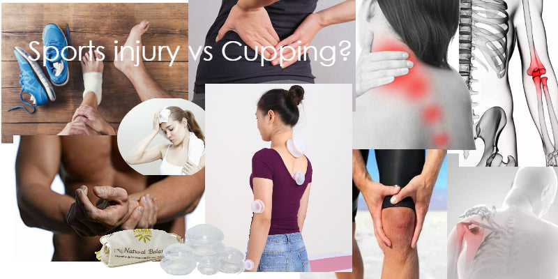 shop cupping sets for sports injuries at lierre canada