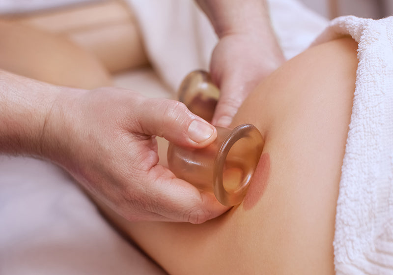 How Does Silicone Cupping Therapy Work and What Does it Help 