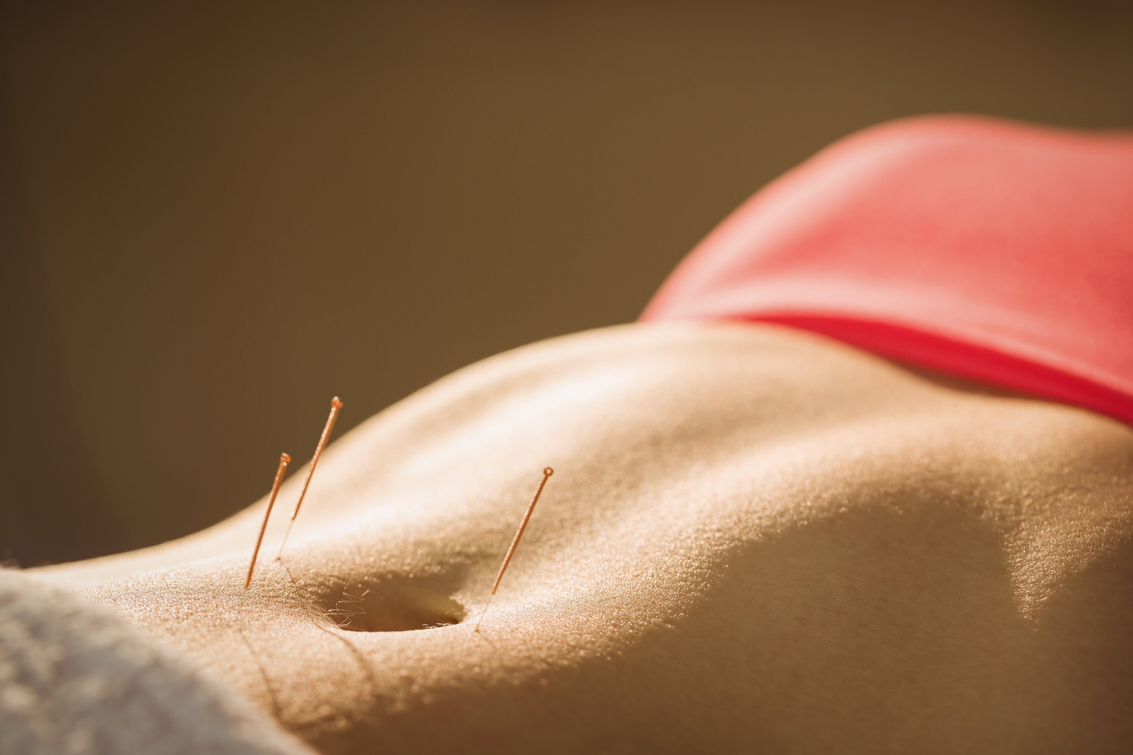 buy acupuncture needles for pain and sleep at lierre.ca