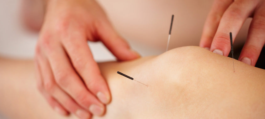 Shop acupuncture needles in laval at lierre