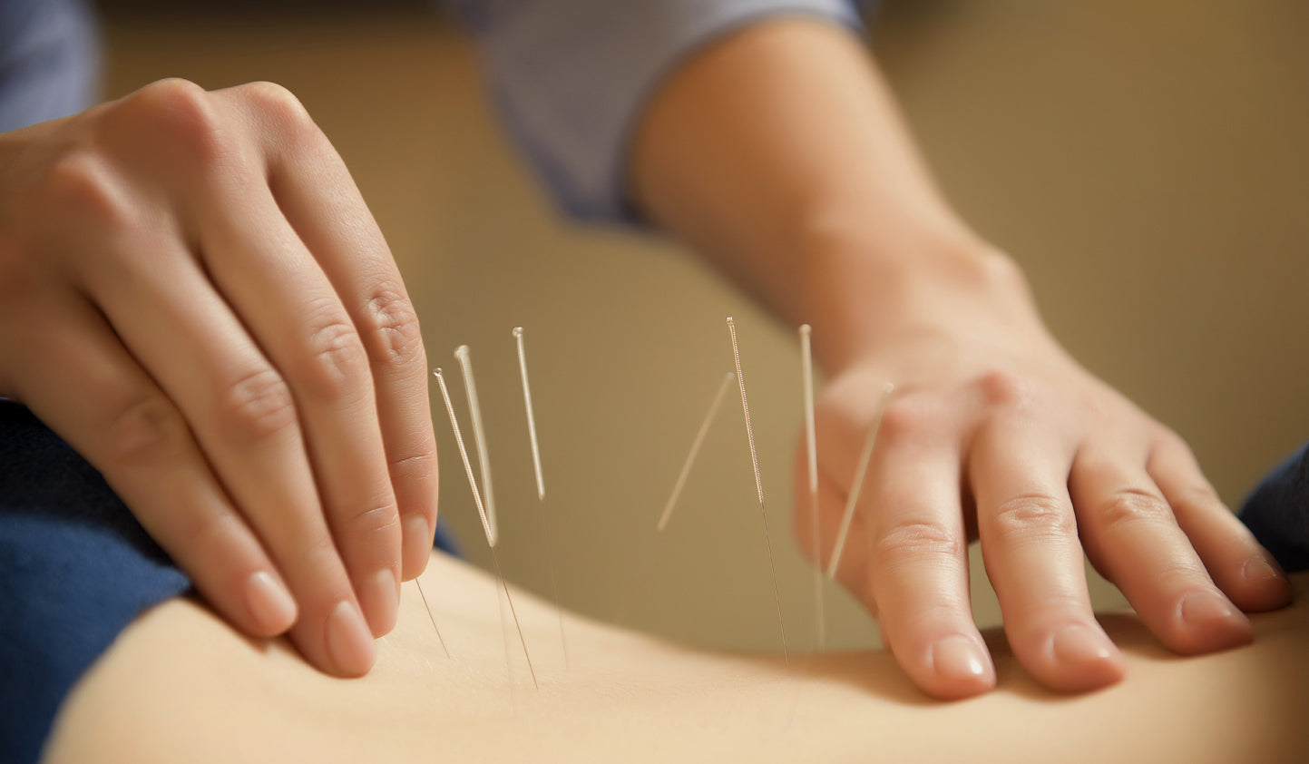 Are acupuncture needles reusable?