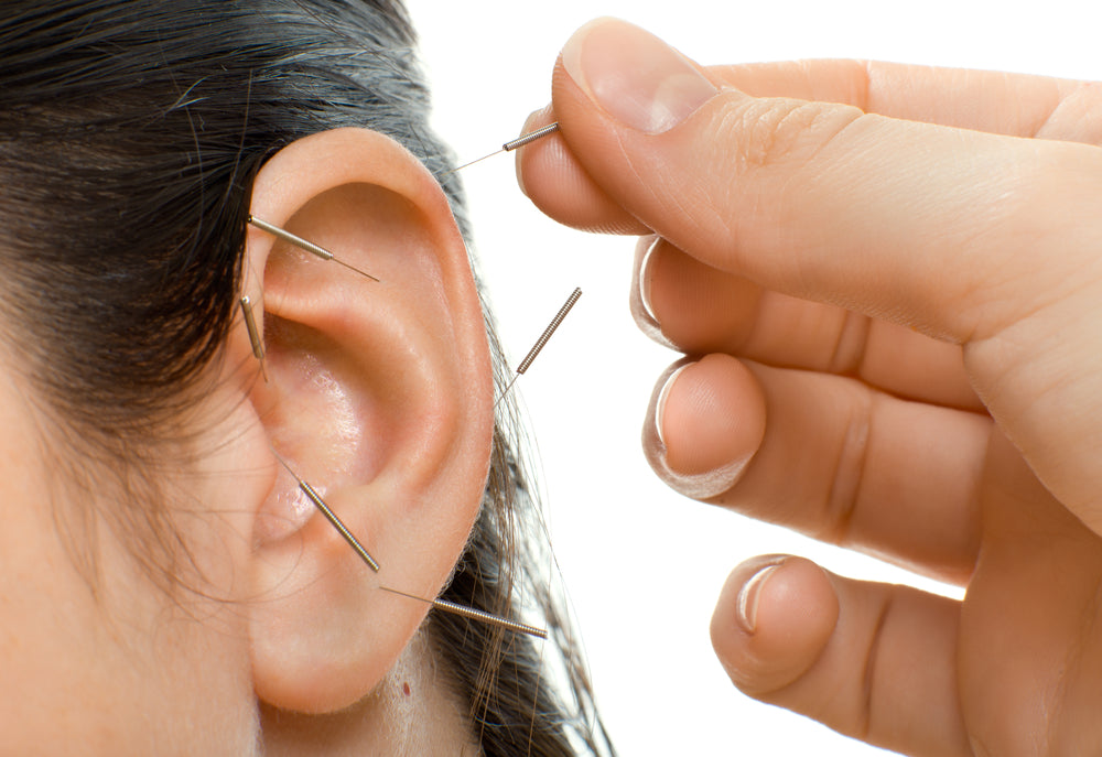 shop ear acupuncture needles at lierre