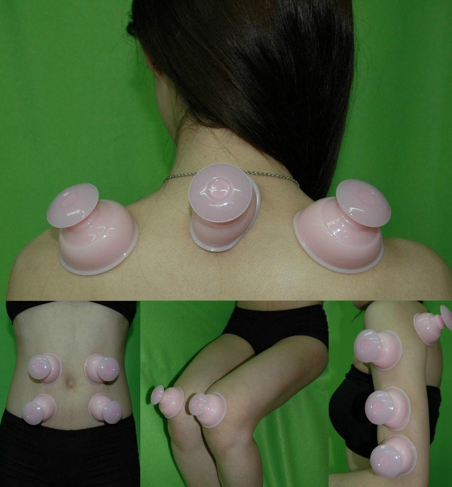 Shop silicone cupping set at lierre canada