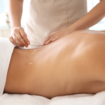 Embracing Acupuncture in Canada as a Means to Solving Pain, Discomfort, and Physical Stress