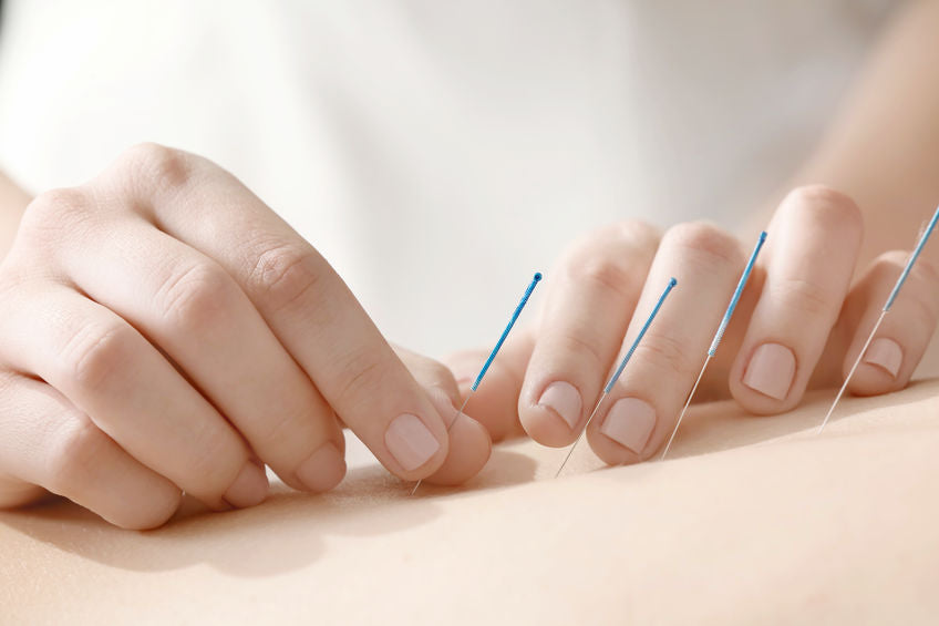 Black Friday May Be the Best Time to Stock Up on Acupuncture Supplies
