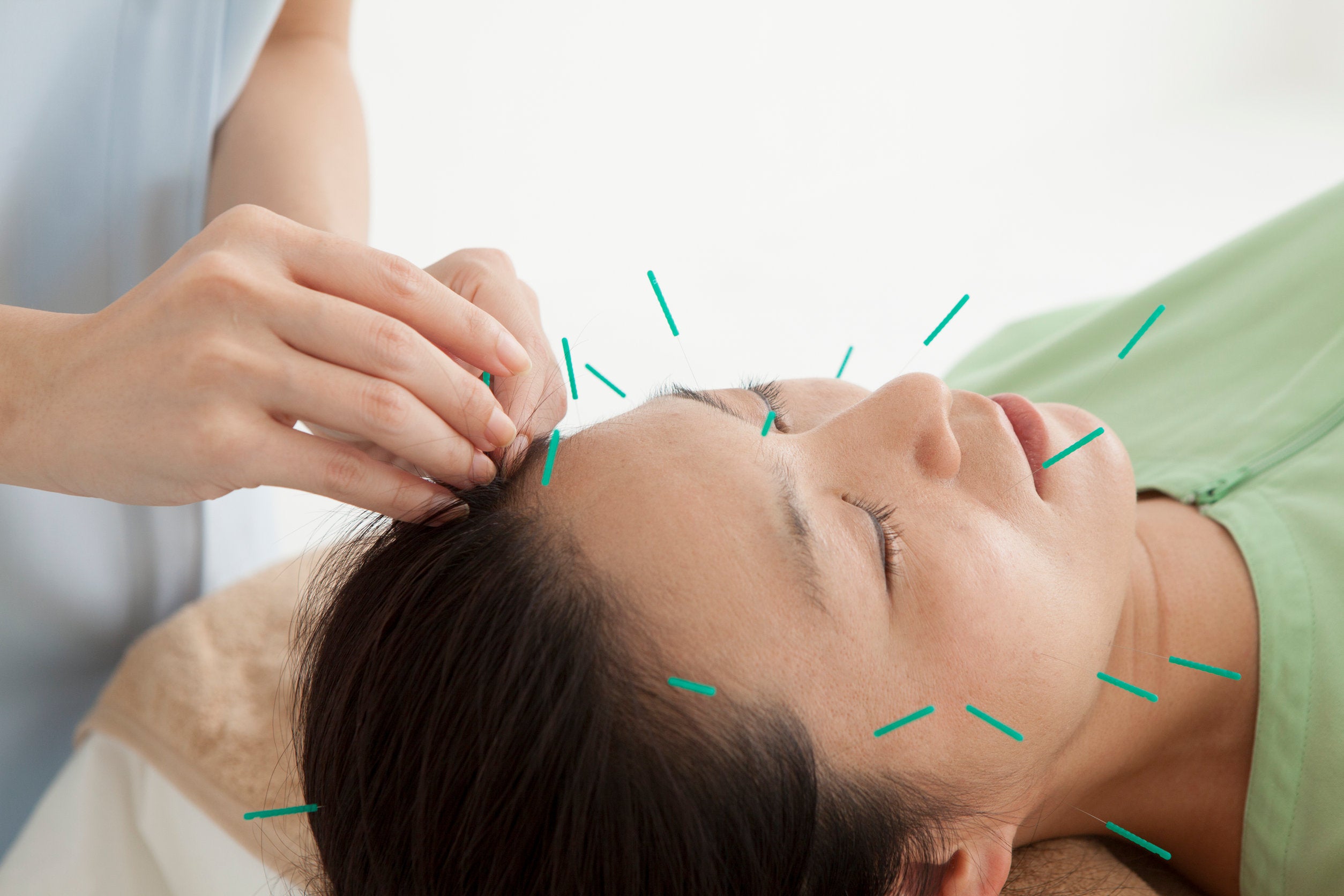How Does Acupuncture Therapy Reduce Inflammation And Minimize Pain?