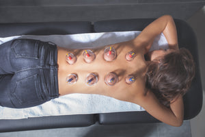 Here Are 14 Steps for How To Do Cupping <a href=