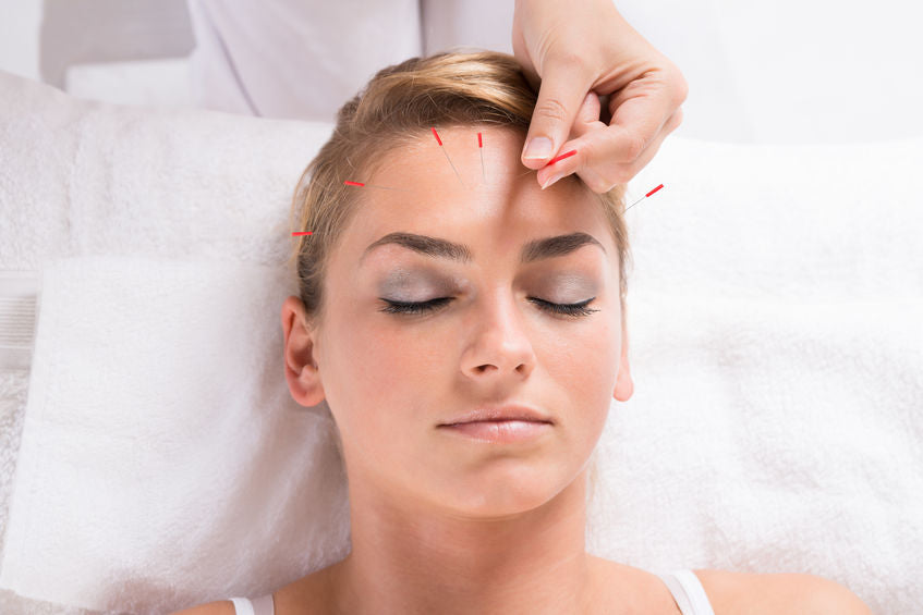 shop high quality acupuncture needles at lierre.ca