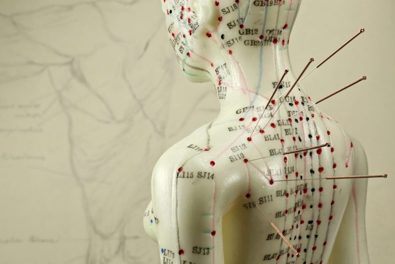 shop acupuncture needles for medical conditions at lierre.ca
