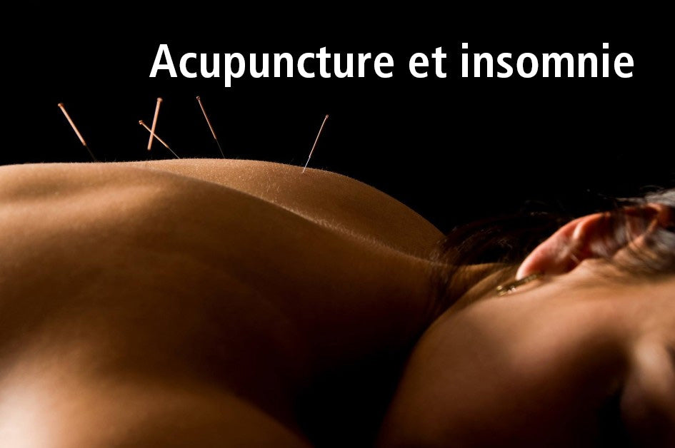 Acupuncture et insomnie