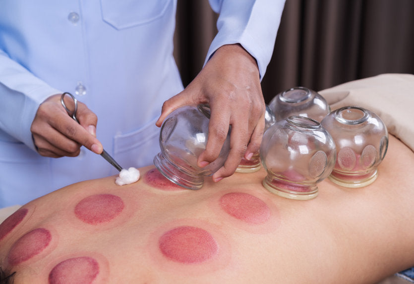 Cupping Therapy: What Causes Blisters?