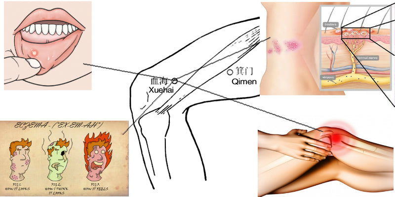 Acupuncture point xue hai