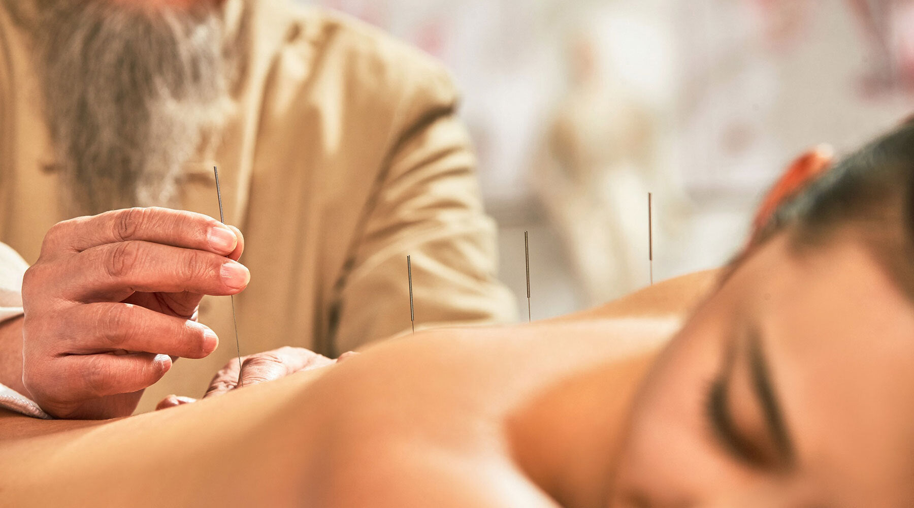 Can Acupuncture Help You Have Better Sex? You Might Be Surprised