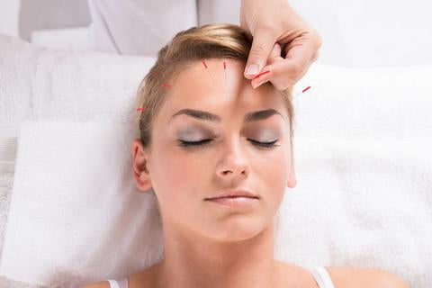 shop acupuncture supplies in canada at lierre.ca