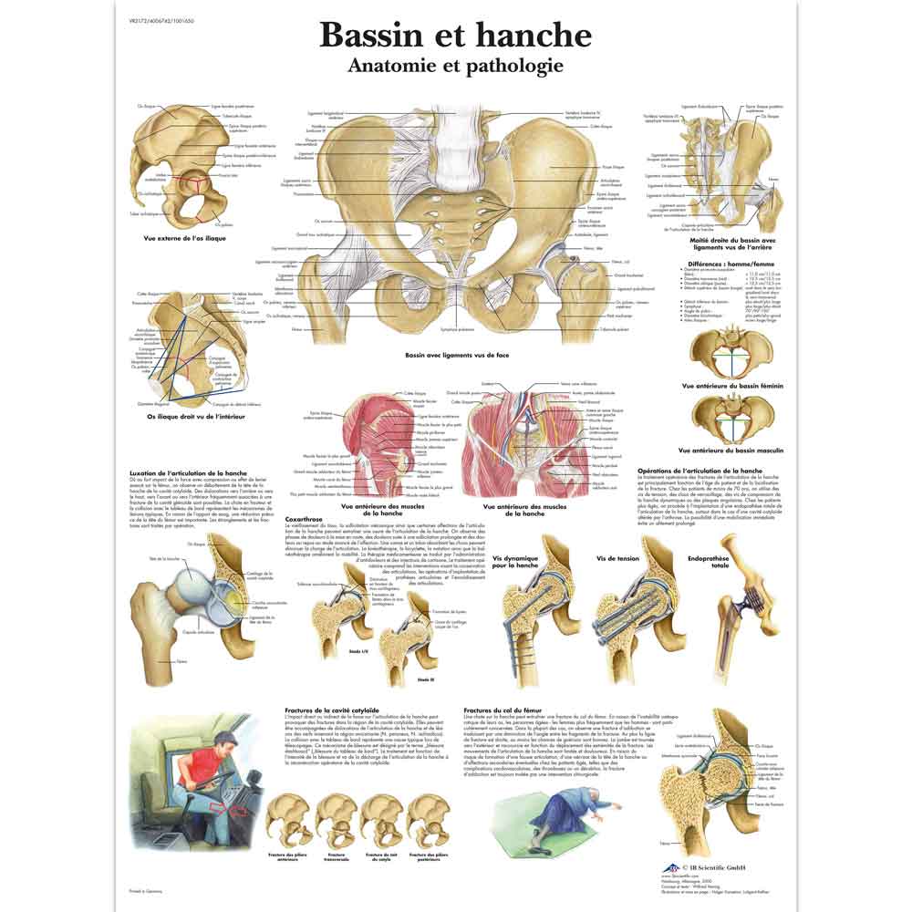 3B Scientific Bassin et hanche antomie et pathologie