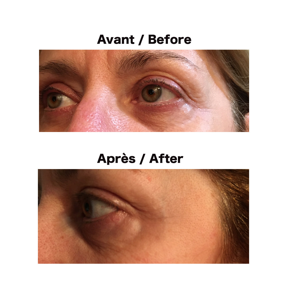 Anti-wrinkle Facial Masks with Hyaluronic Acid Serum 8ml-Secret Strips use before vs. after